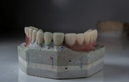 a close up of a tooth model on a table